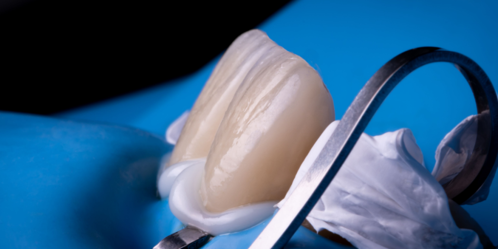 cemento dental cemento dental